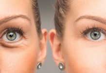 درمان نازک شدن پوست دور چشم