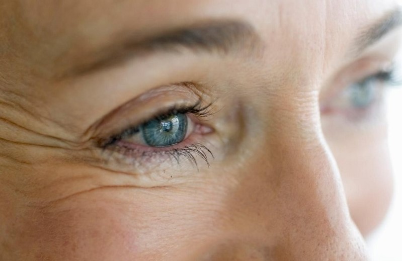 درمان نازک شدن پوست دور چشم