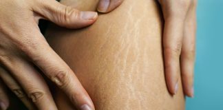 درمان سلولیت