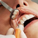 درمان عفونت ریشه دندان