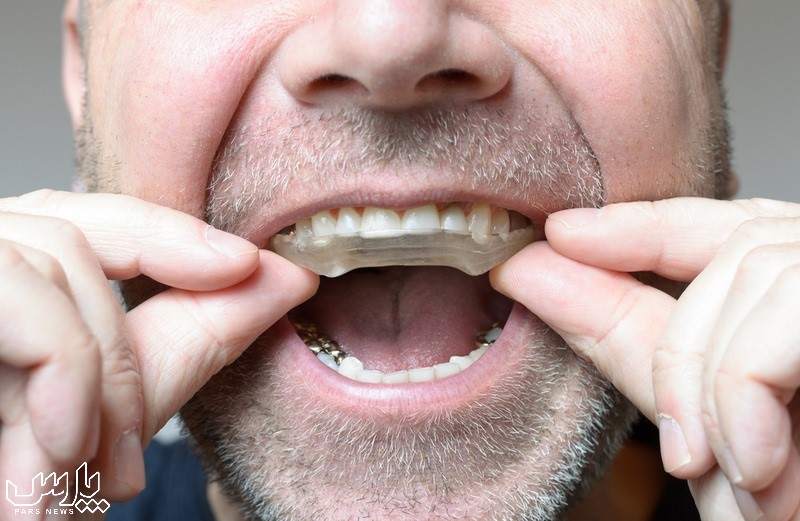 استفاده از گارد شب برای دندان - علت دندان قروچه