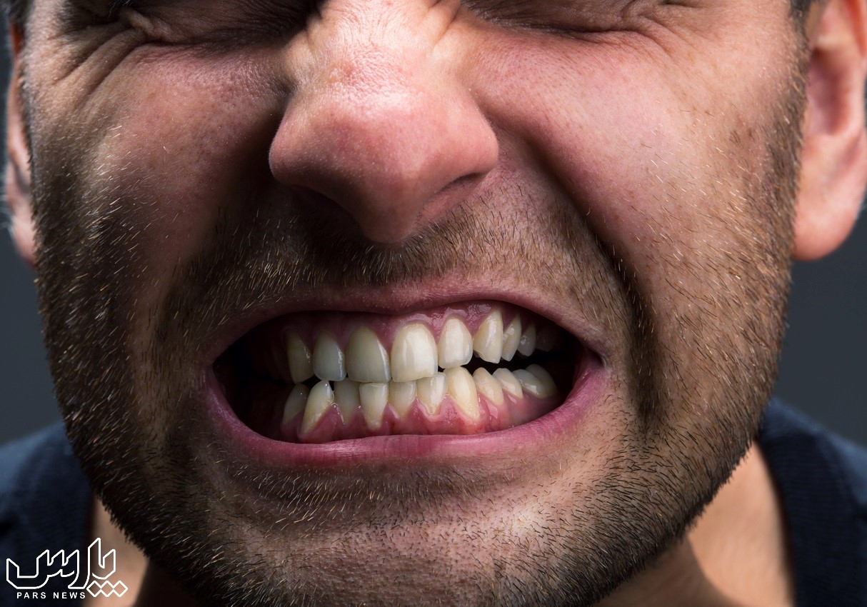 سابیدن دندان به هم - علت دندان قروچه