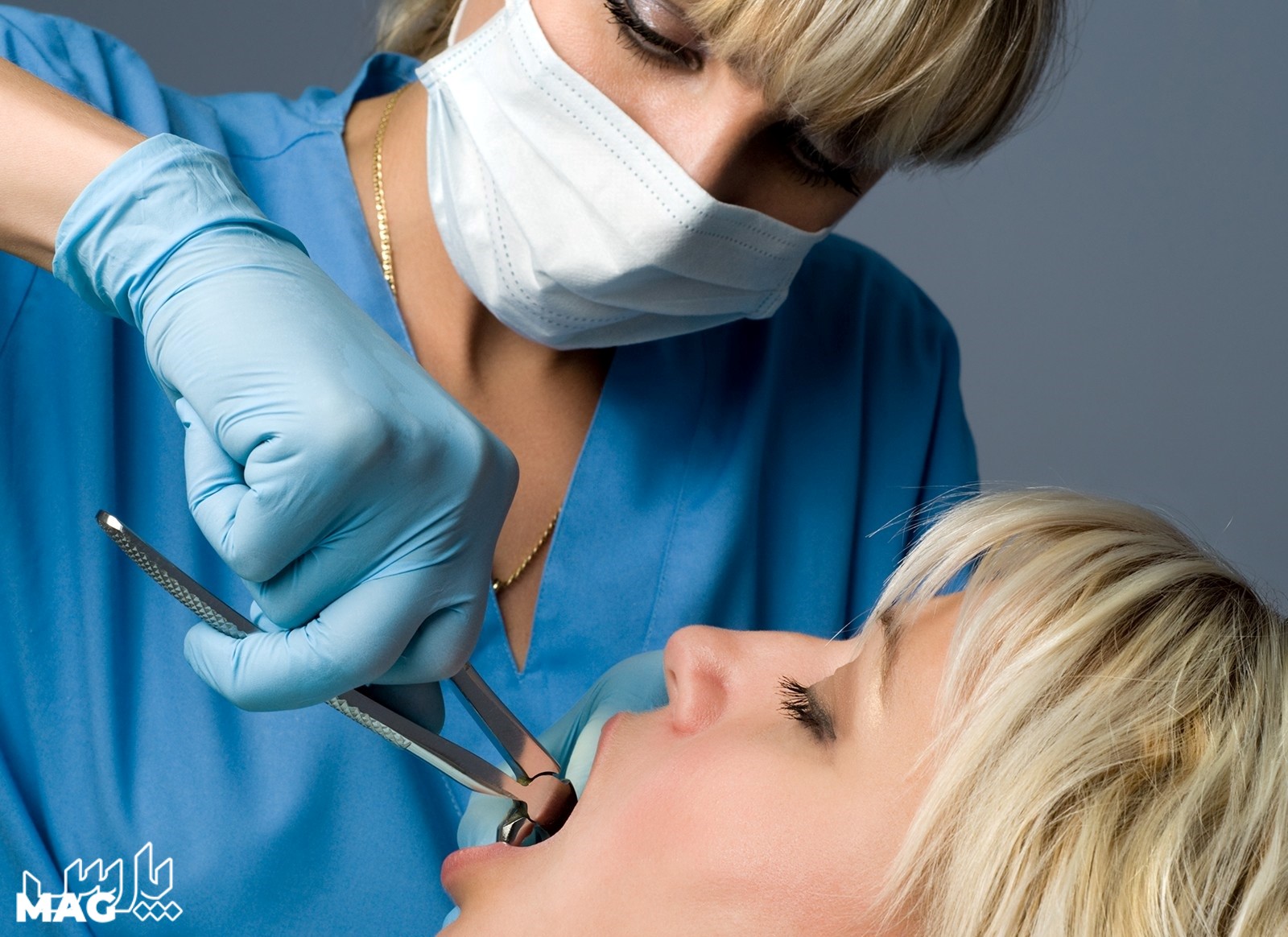 کشیدن دندان - درمان عفونت ریشه دندان