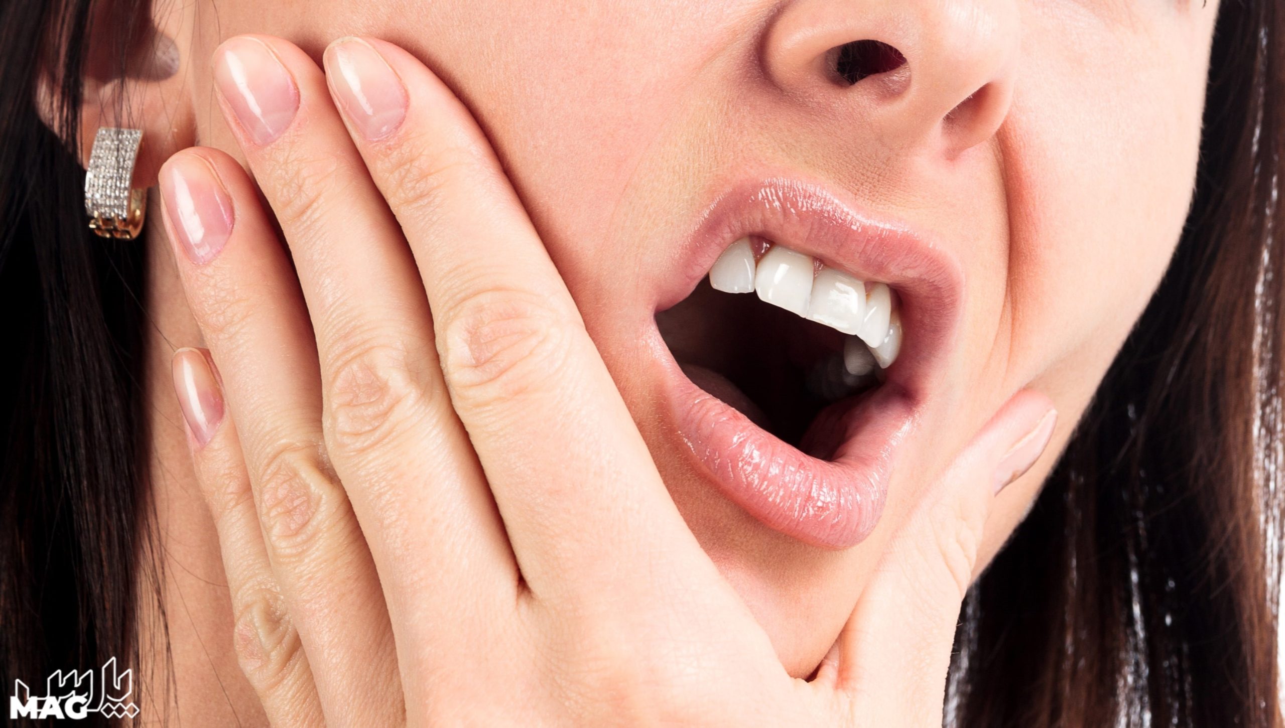 دندان درد - درمان عفونت ریشه دندان