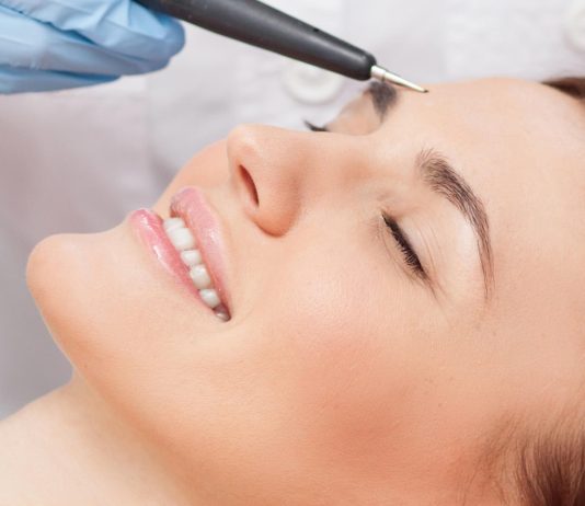 الکترولیز موهای زائد