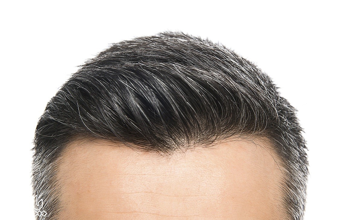 مدل موی مردانه - رشد سریع مو در یک هفته