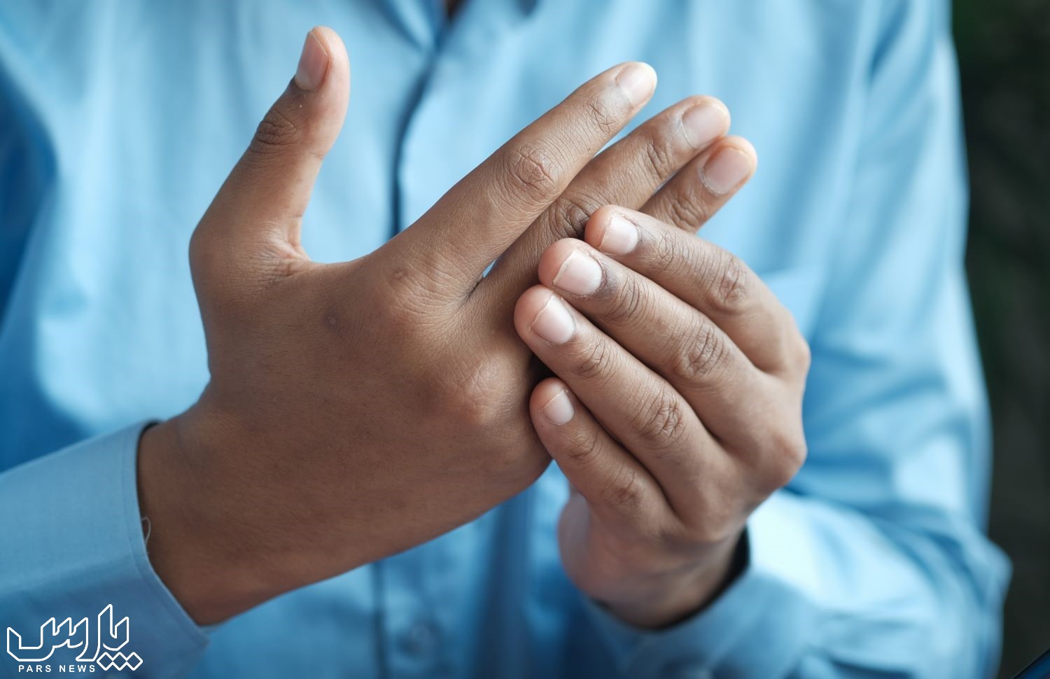 روماتیسم انگشت - درمان روماتیسم مفصلی