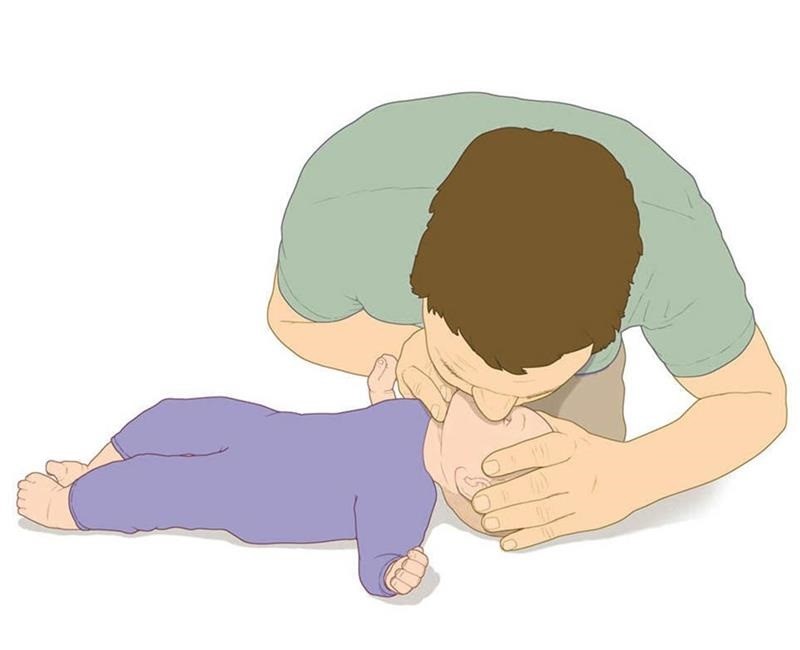 تنفس مصنوعی به نوزاد - کمک های اولیه هنگام خفگی