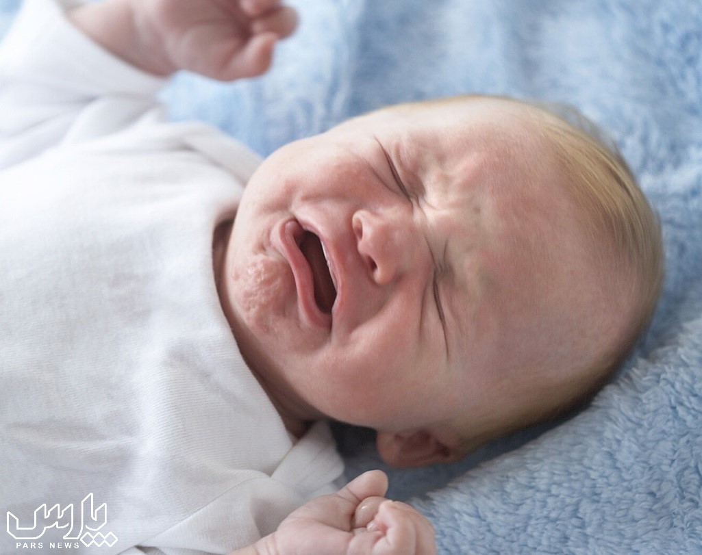 درمان نفخ نوزاد با دارو - نحوه گرفتن نفخ نوزاد