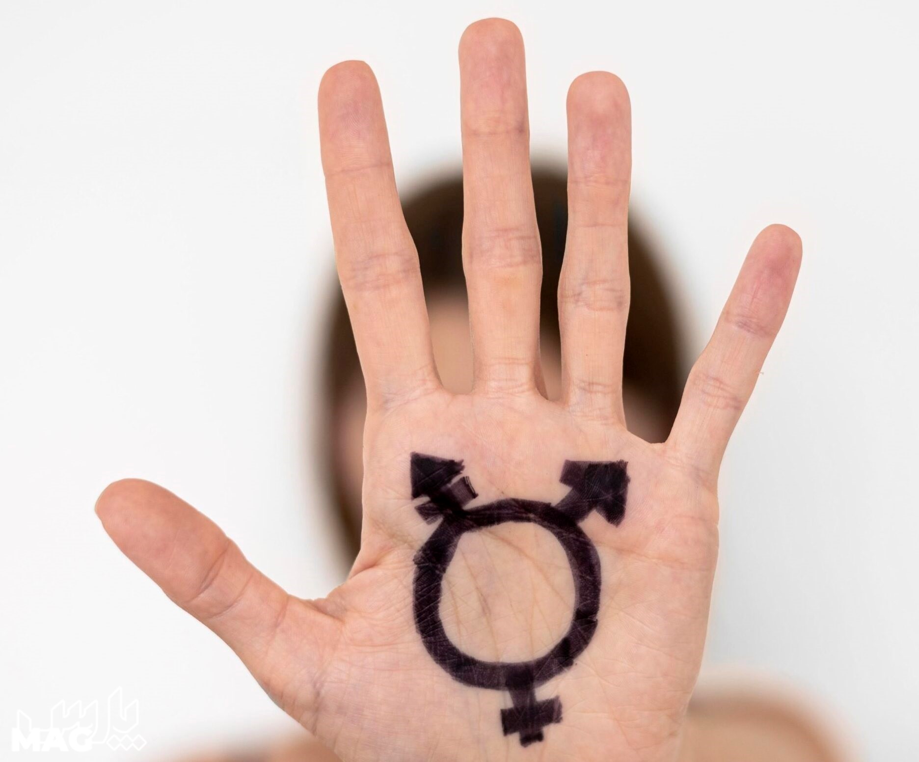 ترنس - عمل تغییر جنسیت
