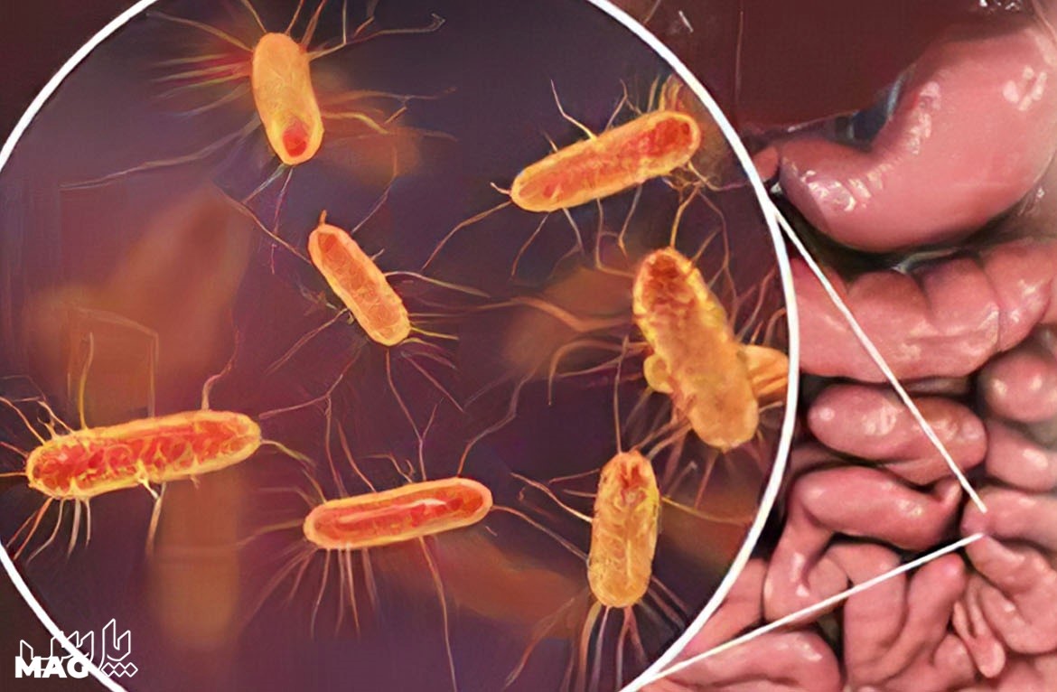 میکروب روده - علائم انگلها در بزرگسالان