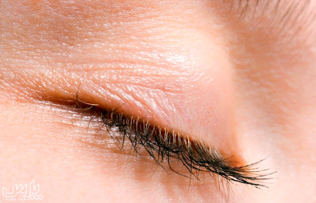 لرزش چشم - علت پریدن پلک به مدت طولانی