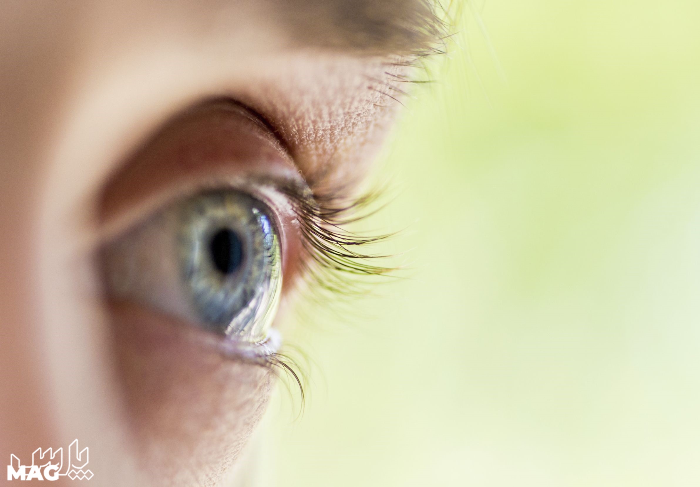 عمل لیزیک چشم - مراقبت های بعد از عمل لیزیک چشم