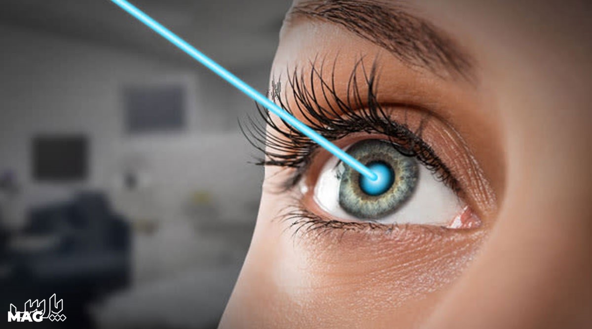 هزینه عمل لیزیک چشم - مراقبت های بعد از عمل لیزیک چشم