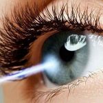 مراقبت های بعد از عمل لیزیک چشم