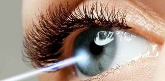 مراقبت های بعد از عمل لیزیک چشم