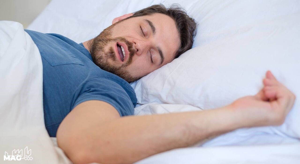خوابیدن با دهان باز - علت خشکی دهان و گلو در خواب