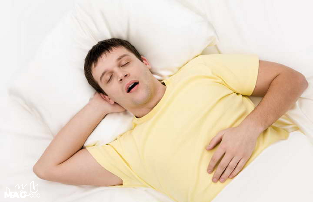 با دهان باز خوابیدن - علت خشکی دهان و گلو در خواب