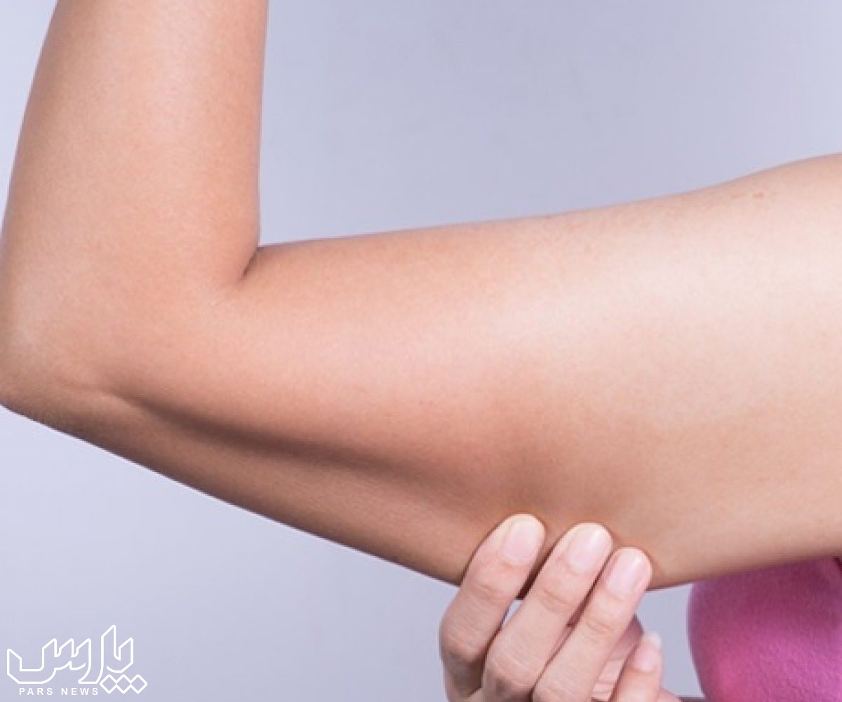 شل شدن بازو - جلوگیری از شل شدن پوست بعد از لاغری