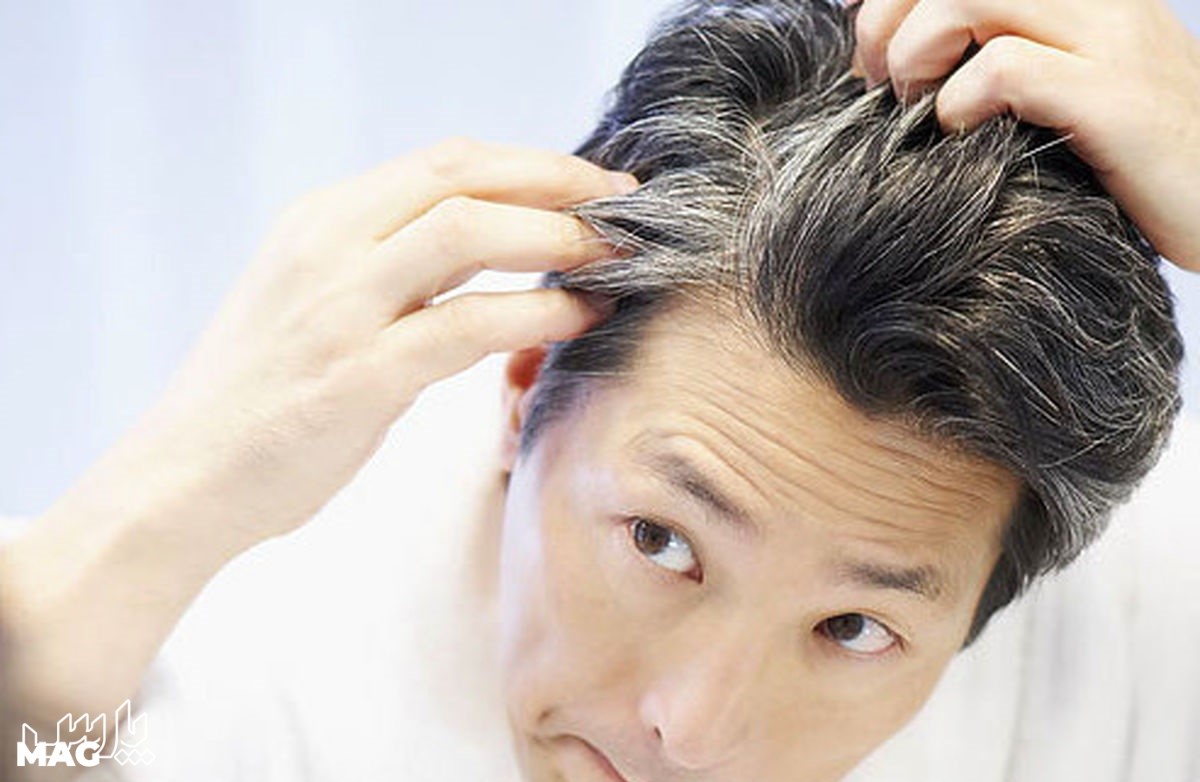 درمان سفیدی مو - رفع سفیدی مو با روغن زیتون