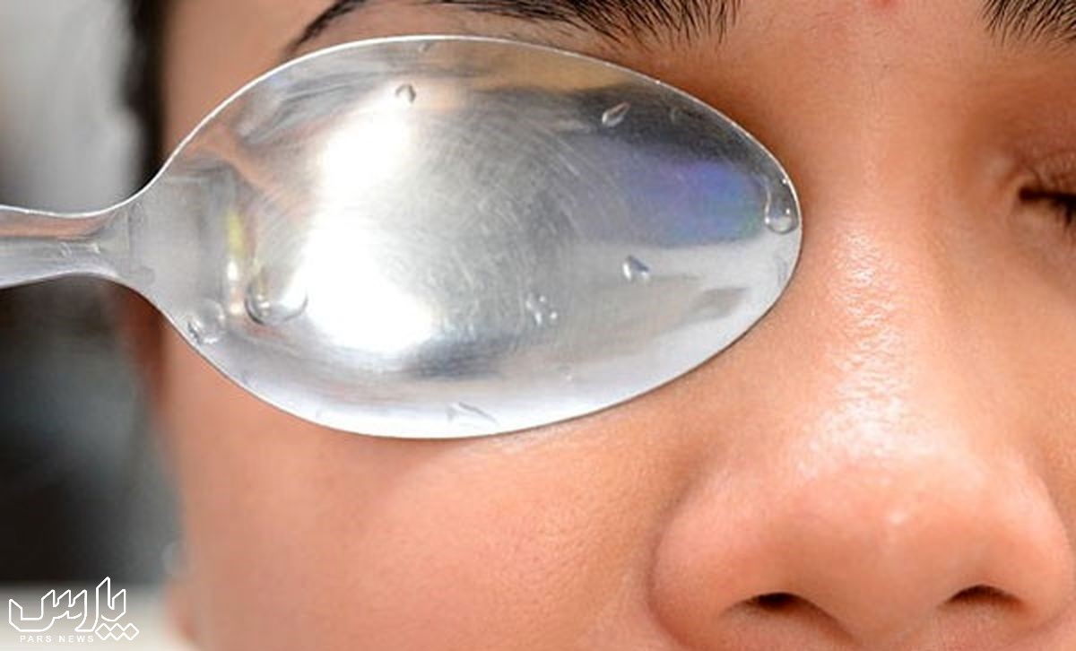 درمان پف چشم - درمان پف زیر چشم در خانه