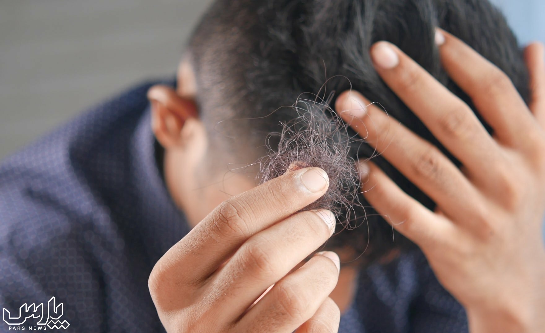 ریزش مو - جلوگیری از ریزش مو با روغن زیتون