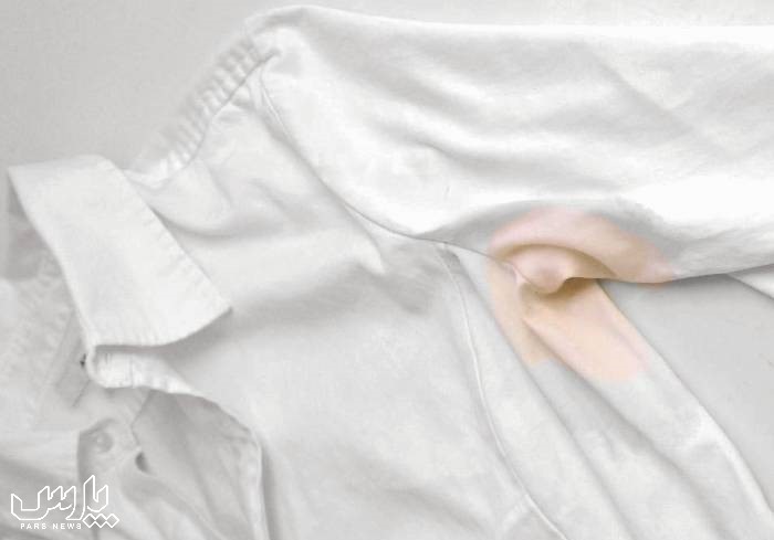 از بین بردن لک لباس - پاک کردن چرک یقه لباس