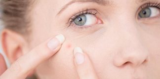 خشک کردن جوش چرکی یک روزه