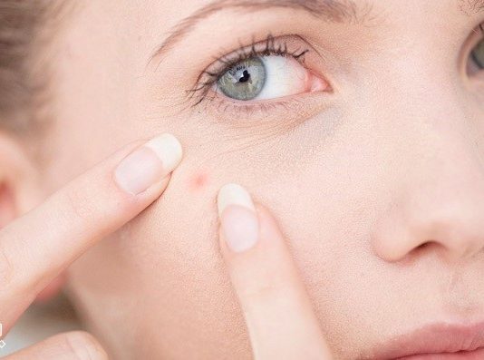 خشک کردن جوش چرکی یک روزه