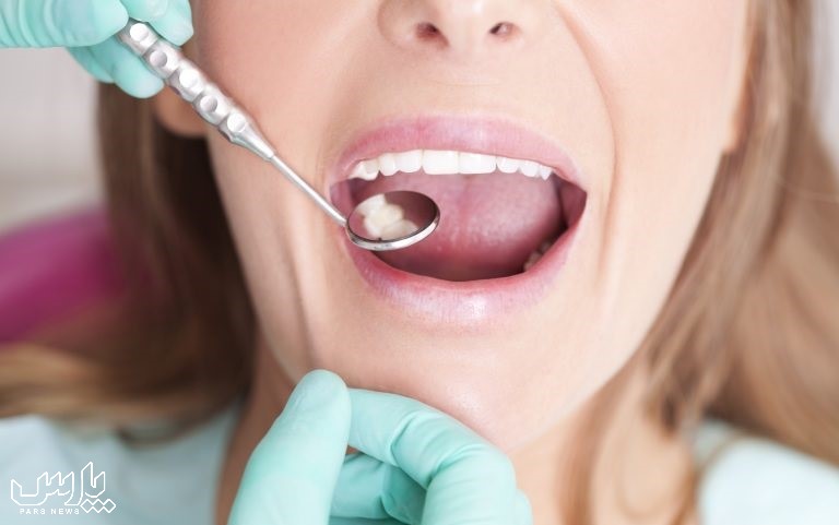 ایمپلنت - ترک خوردن دندان