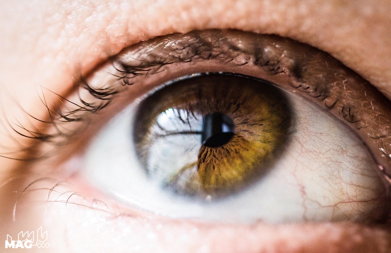 خشک شدن چشم - درمان خشکی چشم در طب سنتی
