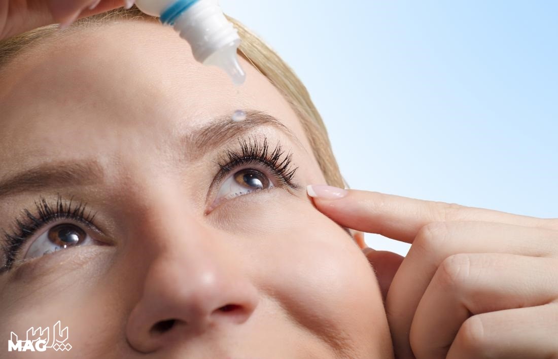 بیماری های چشمی - درمان خشکی چشم در طب سنتی