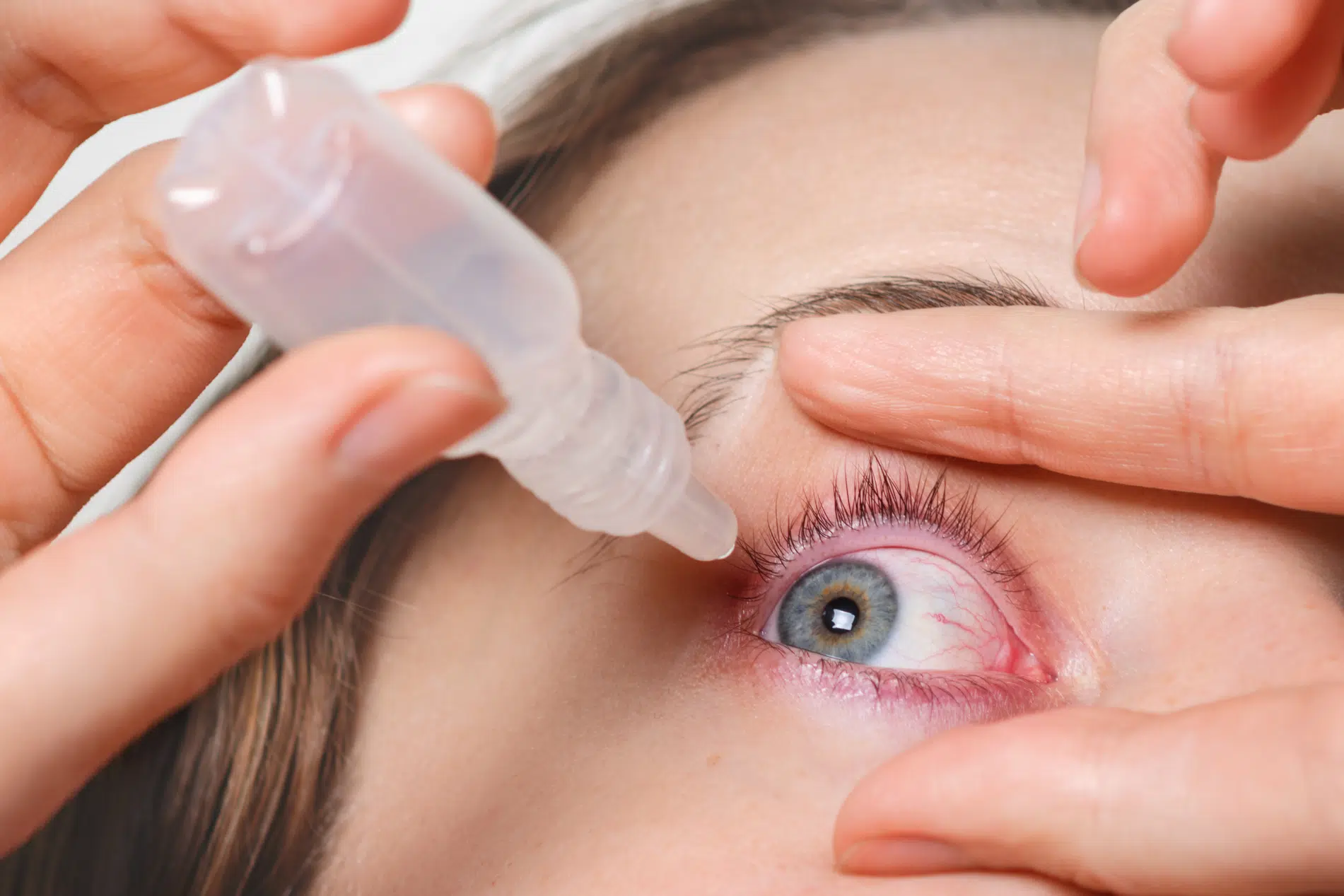 اشک مصنوعی برای درمان قرمزی چشم