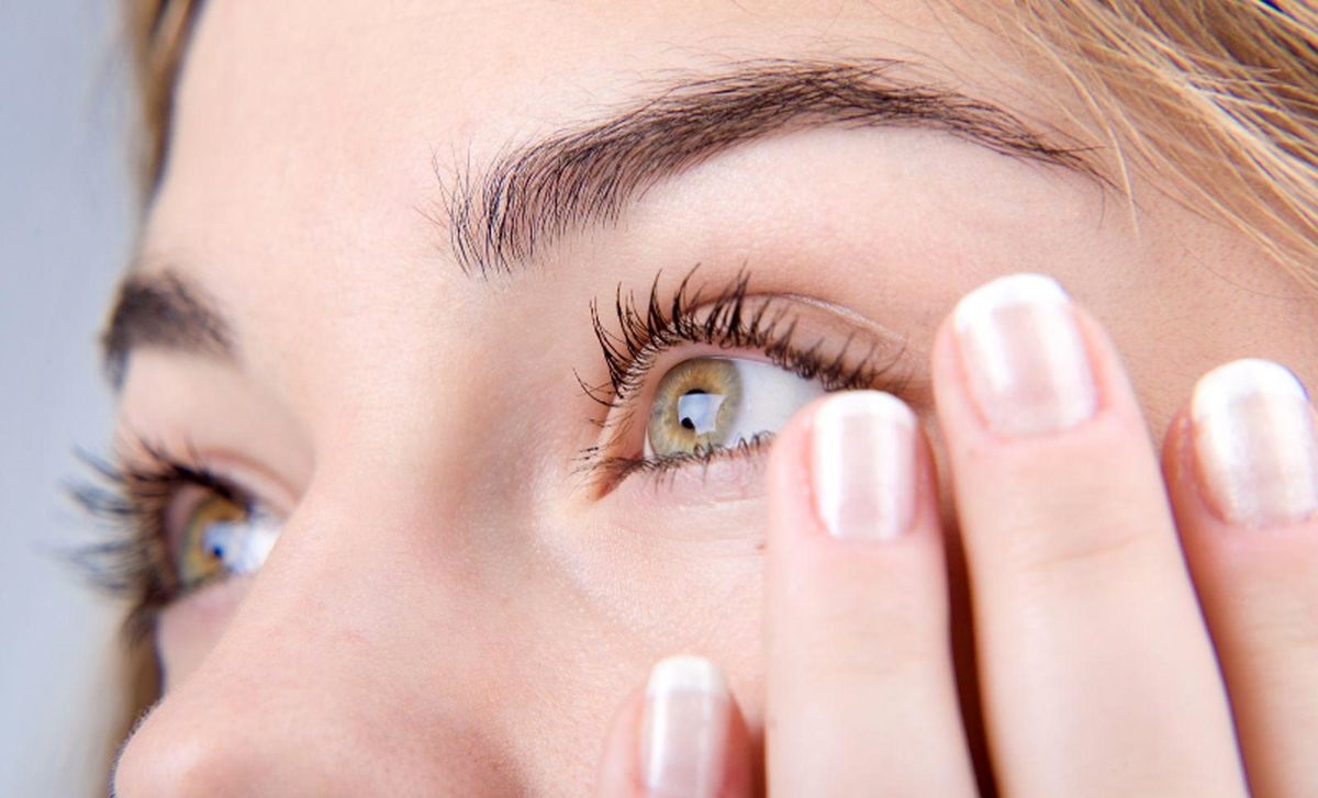 درمان پف زیر چشم - درمان افتادگی پلک