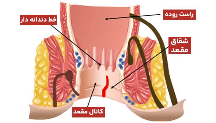 images_1690606394_64c49b3a1cfd5