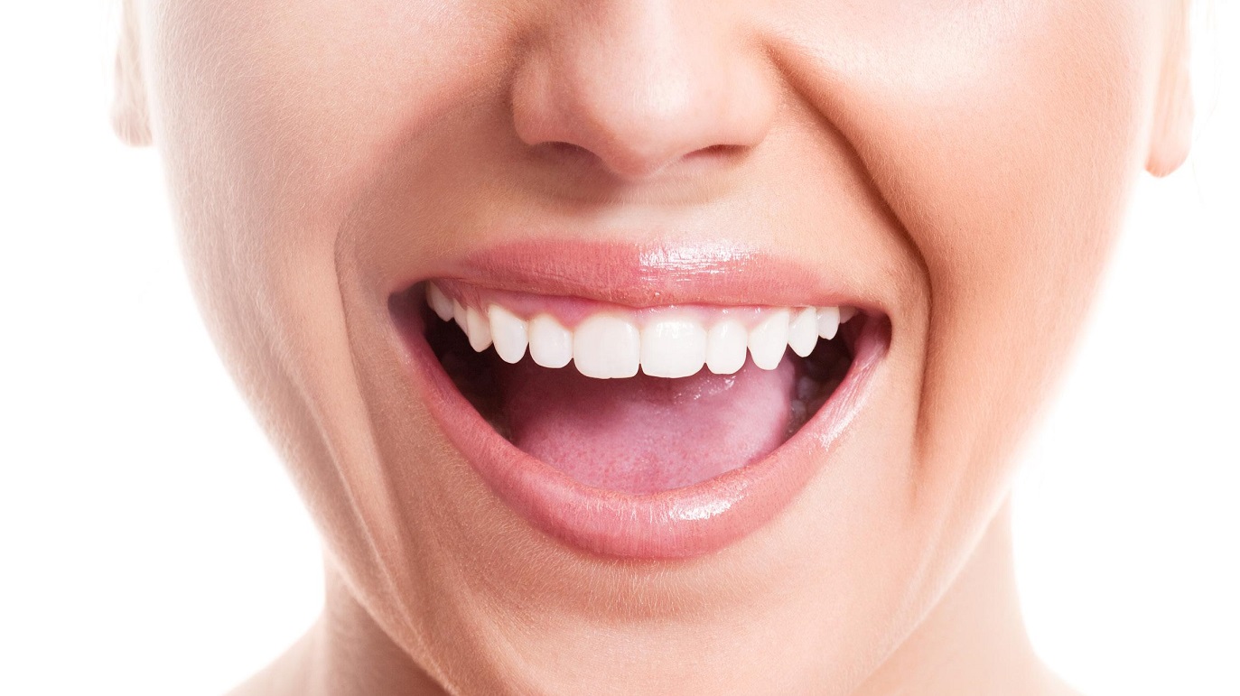 سفید کردن دندان - از بین بردن زردی دندان