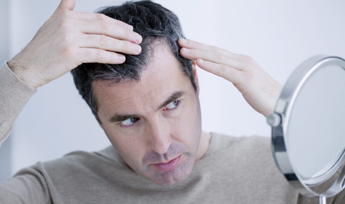 ریزش مو در مردان - درمان سریع ریزش مو