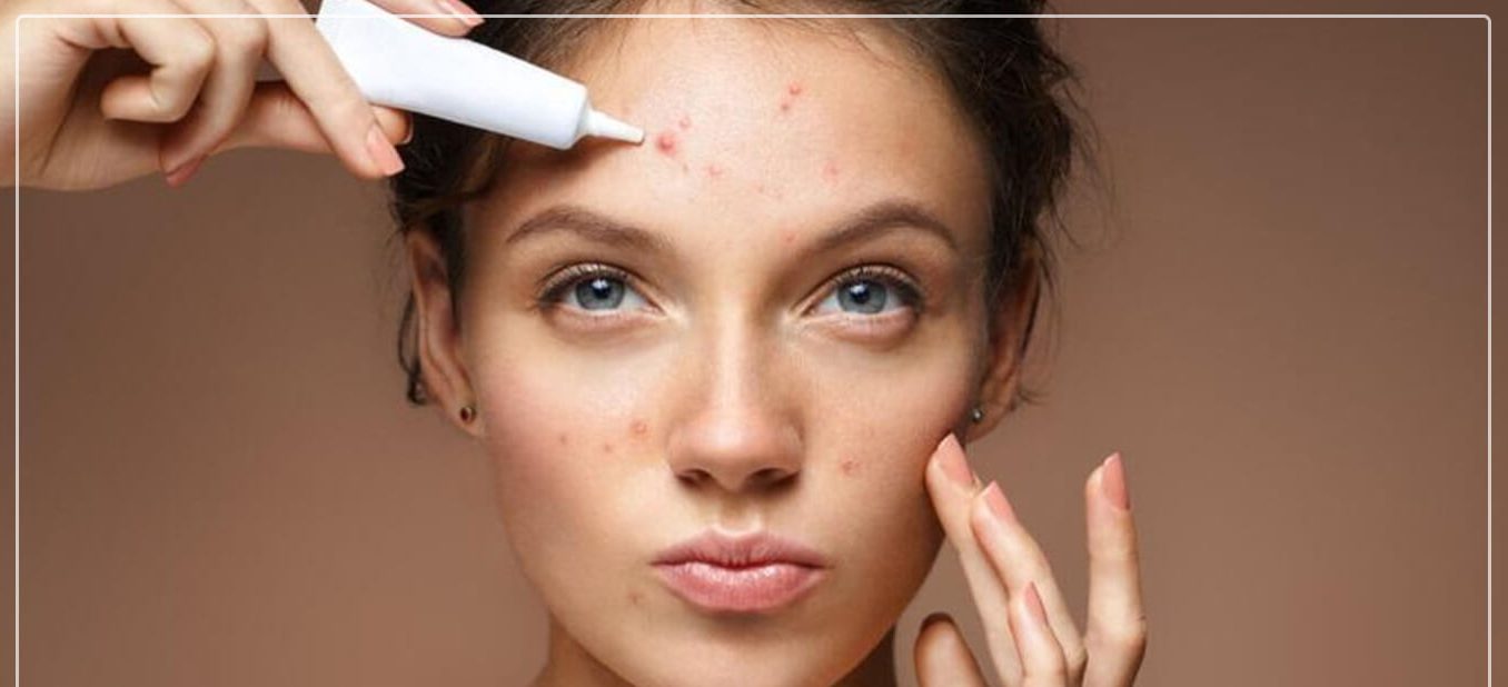 خطر آرایش - لک شدن پوست