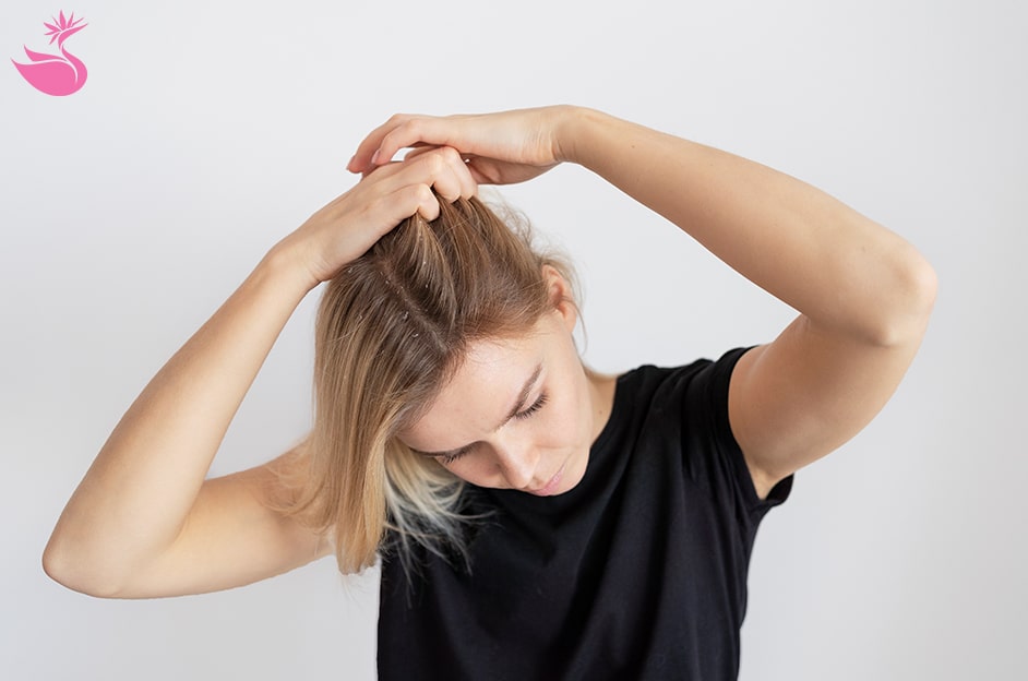 درمان ریزش مو با روغن رزماری