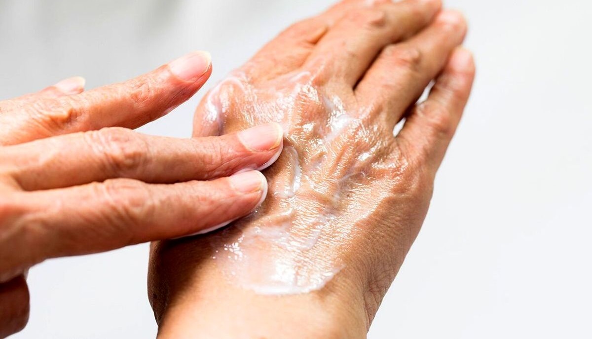 کرم مرطوب کننده ی دست - درمان خشکی پوست دست