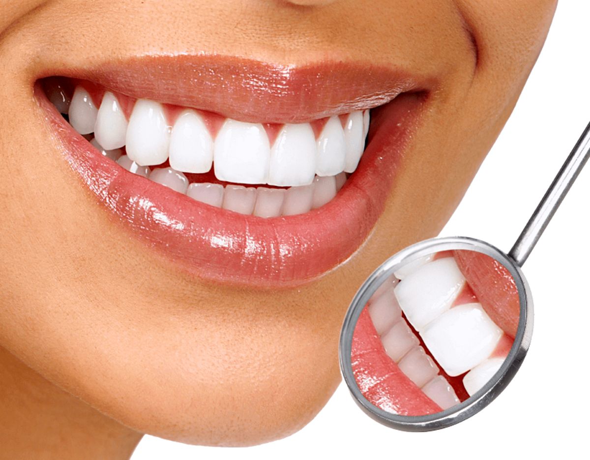 جرم گیری دندان در خانه - دندان سفید
