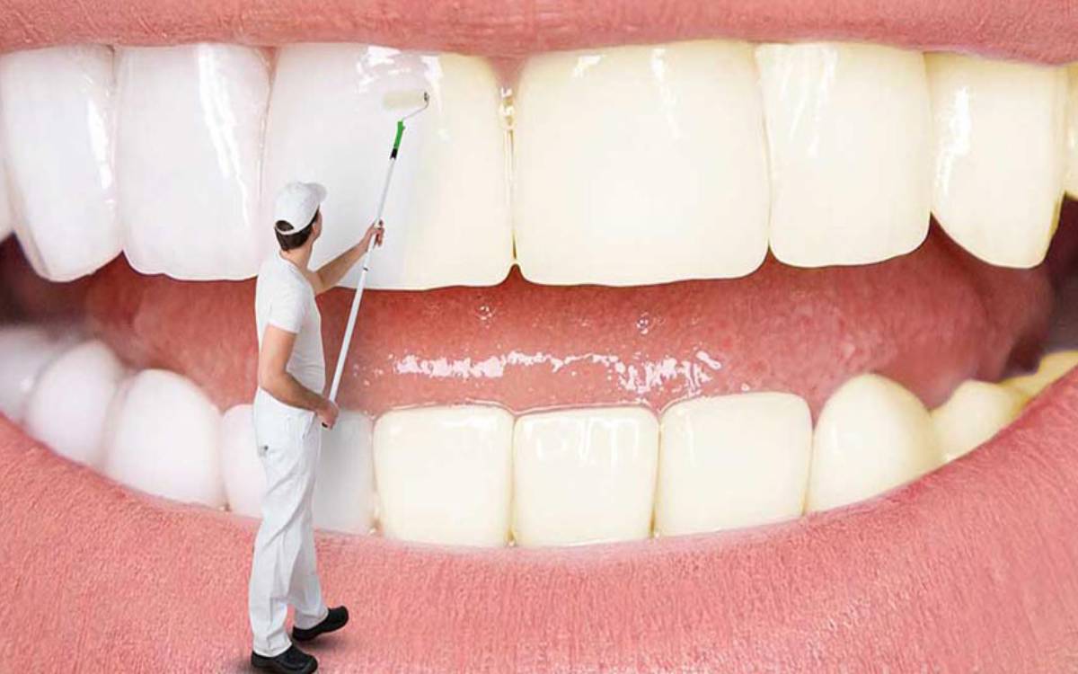 جرم گیری دندان در خانه - مرد و دندان