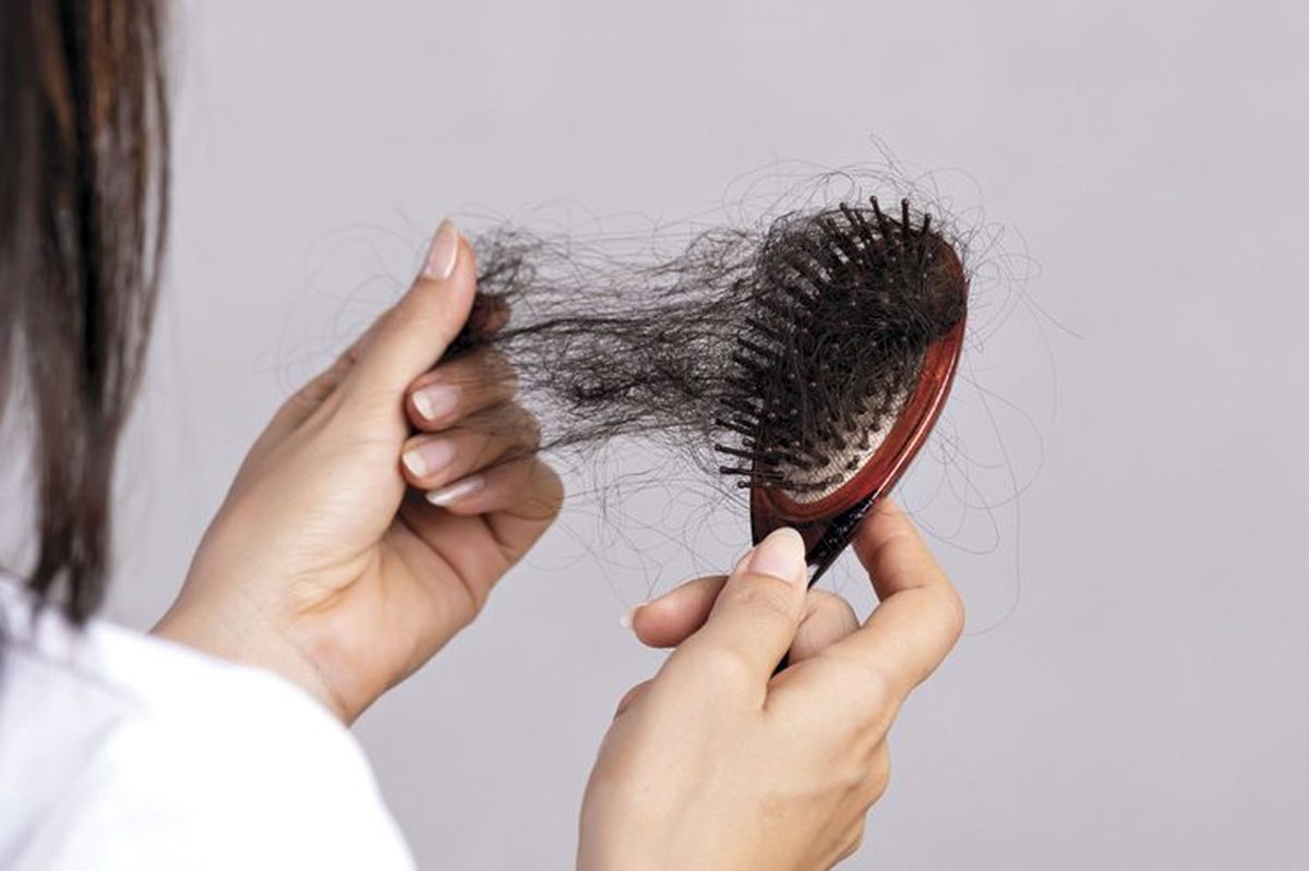ریزش مو بعد از زایمان - مو در برس