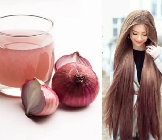 آب پیاز برای ریزش مو