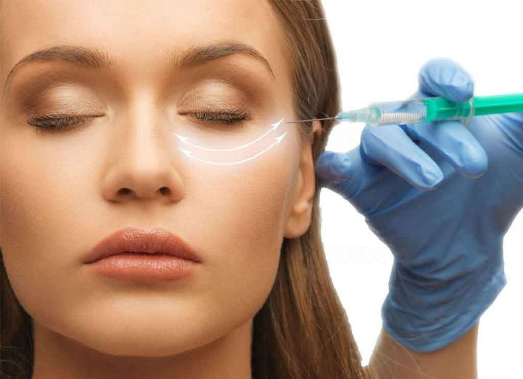 بوتاکس زیر چشم - درمان گودی زیر چشم