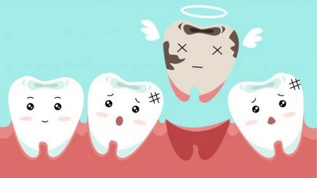 دندان شیری - کاریکاتور