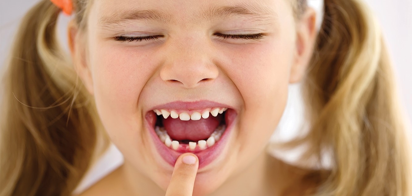 دندان شیری - دختر بچه