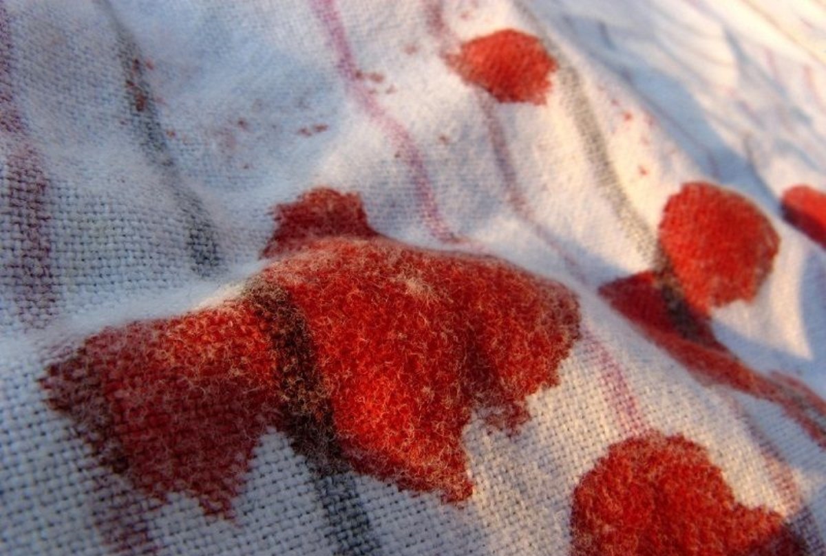 پاک کردن لکه خون خشک شده از لباس
