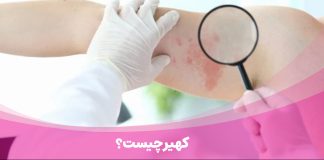 کهیر