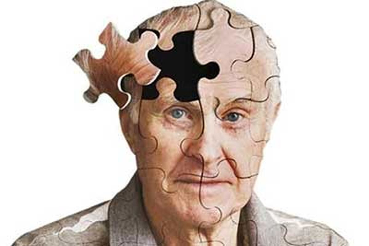 علائم آلزایمر - پازل مرد